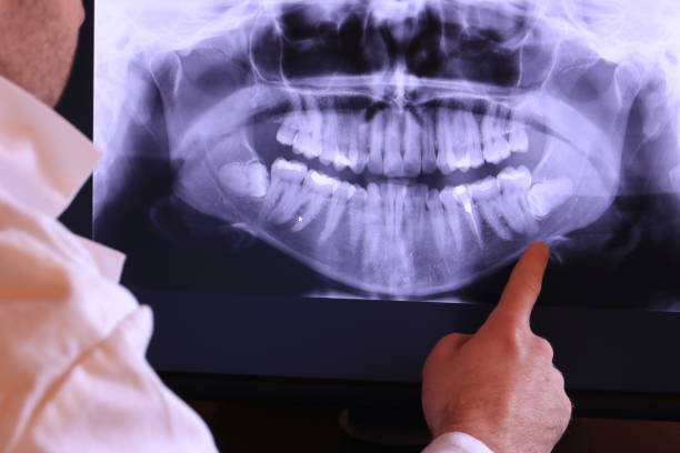 Best Dentist for Tooth Abscess  in Wrens, GA