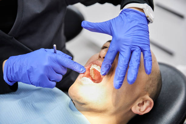 Best Cracked Tooth Emergency Dentist  in Wrens, GA